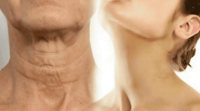 Изображение [Татьяна Курчина] Шея как у королевы (2025)