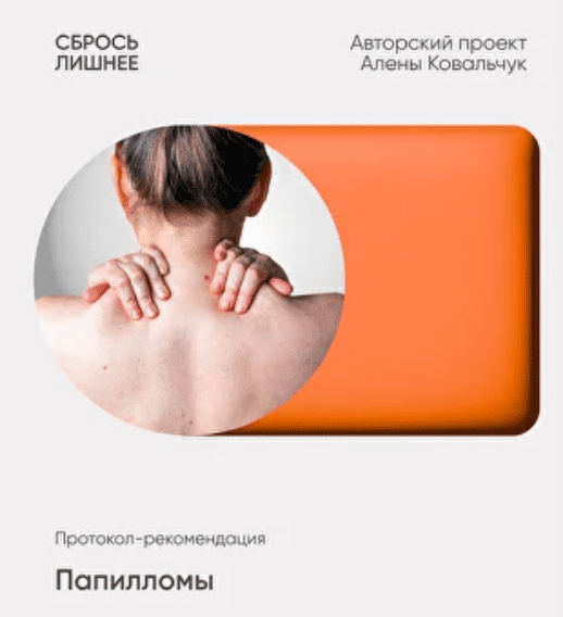 Изображение [Алёна Ковальчук] Папилломы (2025)