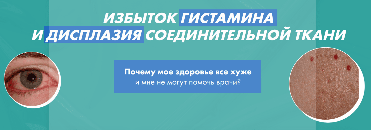 Изображение [Дарья Ермишина] Избыток гистамина и дисплазия соединительной ткани (2025)